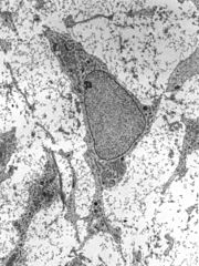 Mesenchymal Stem Cells (MCS)